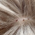 How can i tell if my cat has fleas or ticks?